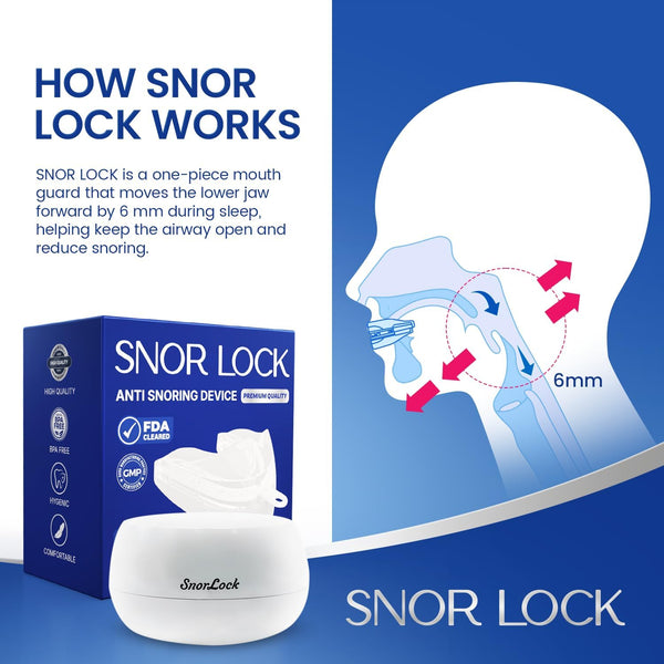 SNOR LOCK - Anti Snoring Devices and Mouthpiece (Trio)