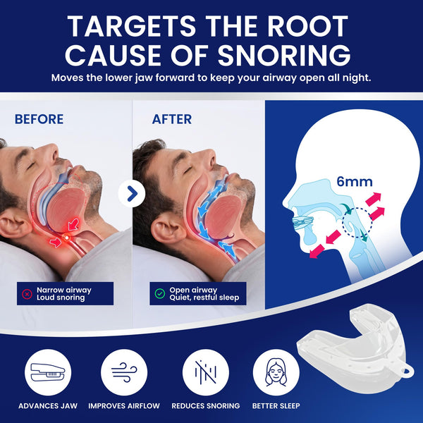 How SNOR LOCK works: moves the lower jaw forward to help keep the airway open
